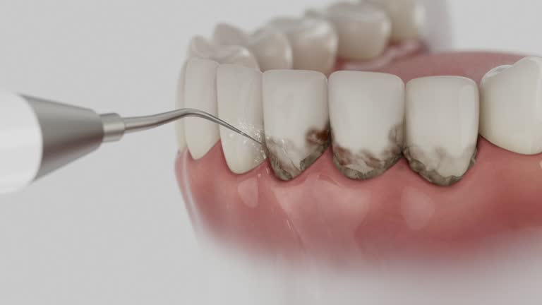 Trusted Teeth Cleaning And Checkup service in Fort Rucker, AL - Dentist Open Now
